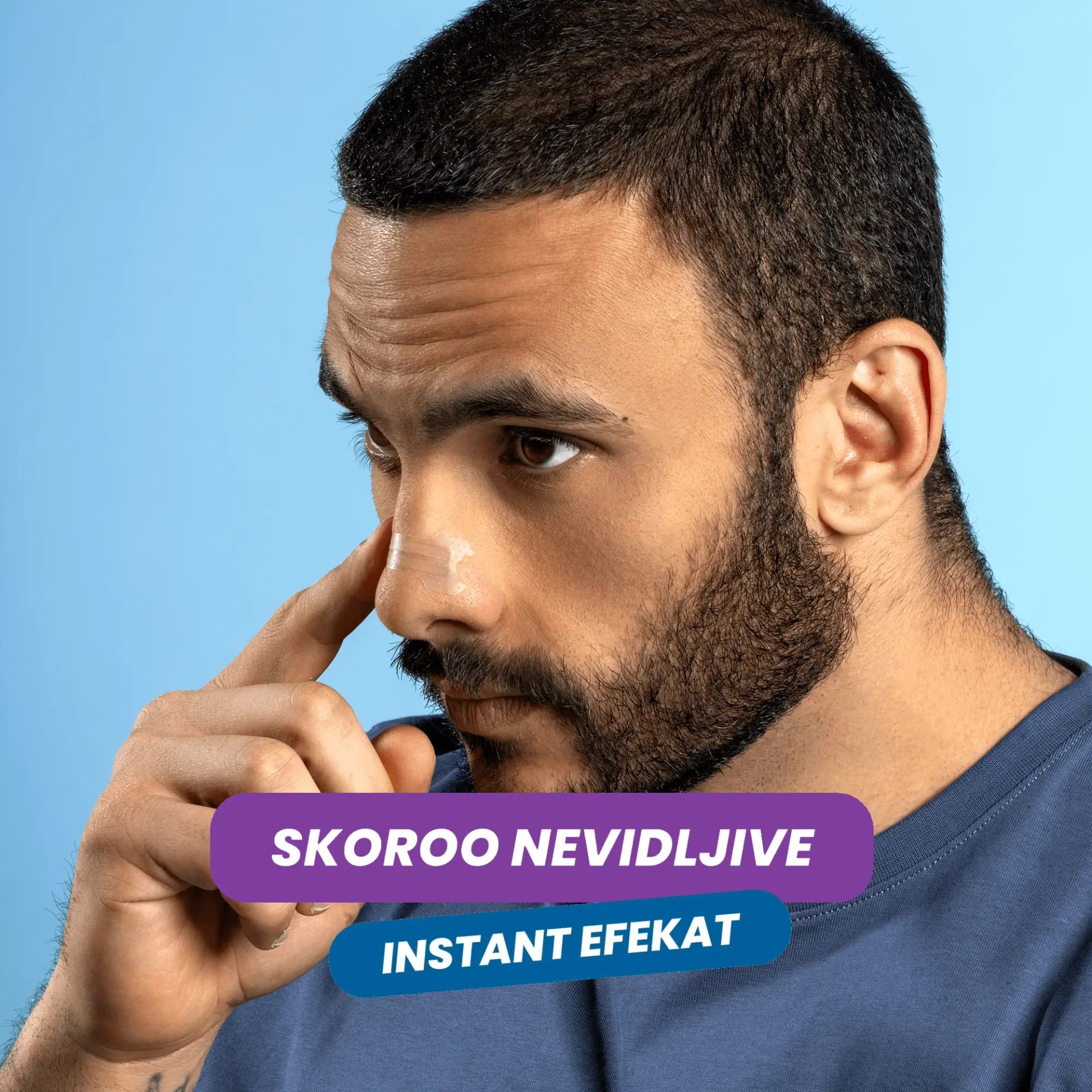 Makro snimak Noro trakice zalepljene preko korena nosa, iz profila